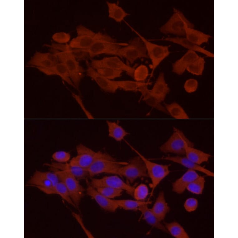 Immunofluorescence - Anti-GPBB Antibody (A15212) - Antibodies.com