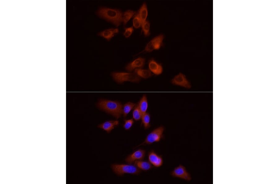 Immunofluorescence - Anti-GPBB Antibody (A15212) - Antibodies.com
