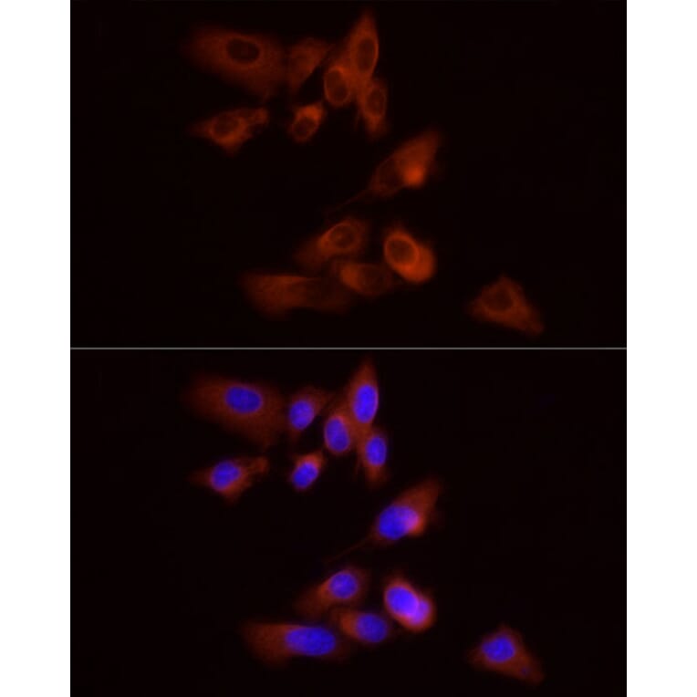 Immunofluorescence - Anti-GPBB Antibody (A15212) - Antibodies.com