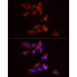 Immunofluorescence - Anti-GPBB Antibody (A15212) - Antibodies.com