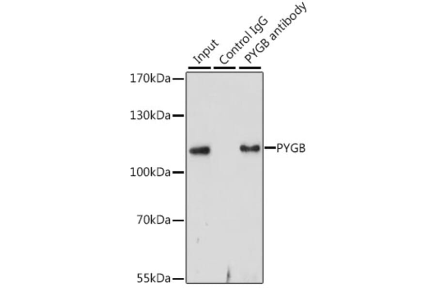 Western Blot - Anti-GPBB Antibody (A15212) - Antibodies.com