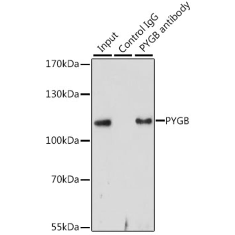 Western Blot - Anti-GPBB Antibody (A15212) - Antibodies.com