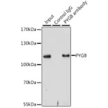 Western Blot - Anti-GPBB Antibody (A15212) - Antibodies.com