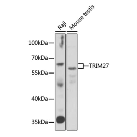 Western Blot - Anti-TRIM27 Antibody (A15213) - Antibodies.com