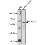 Western Blot - Anti-TRIM27 Antibody (A15213) - Antibodies.com