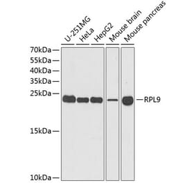 Western Blot - Anti-RPL9 Antibody (A15214) - Antibodies.com