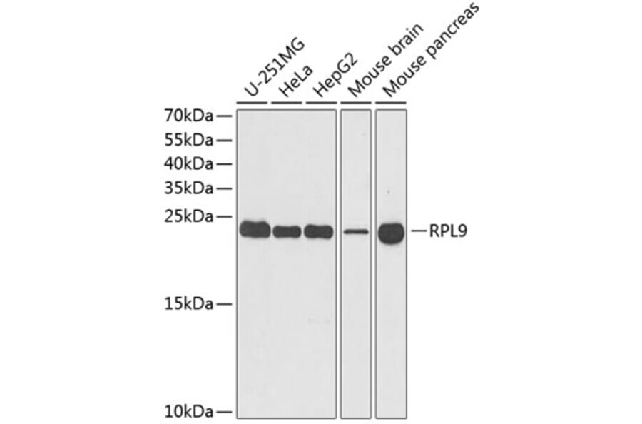 Western Blot - Anti-RPL9 Antibody (A15214) - Antibodies.com