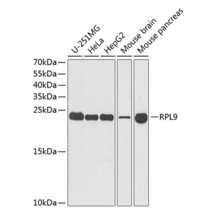 Western Blot - Anti-RPL9 Antibody (A15214) - Antibodies.com