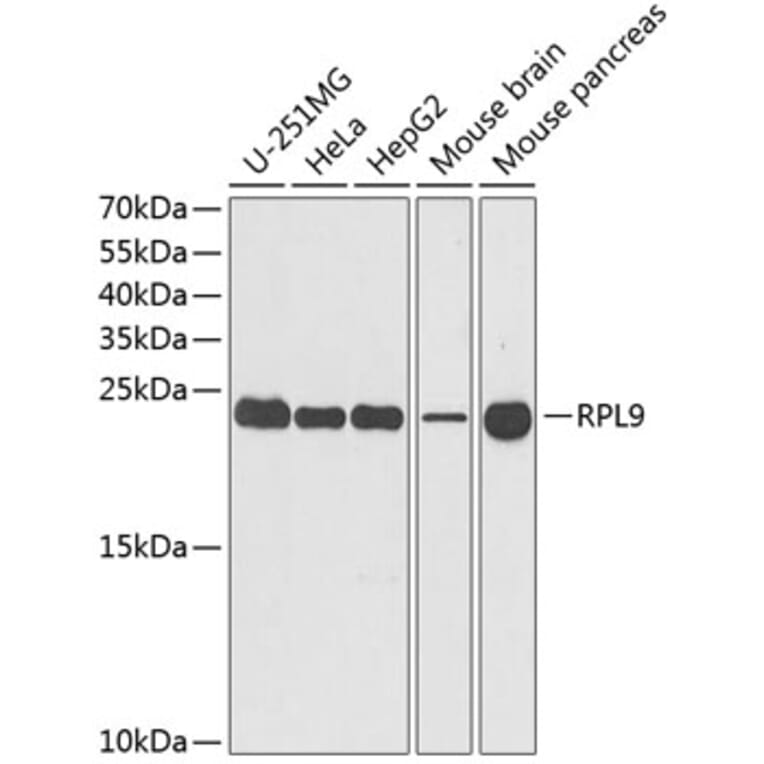 Western Blot - Anti-RPL9 Antibody (A15214) - Antibodies.com