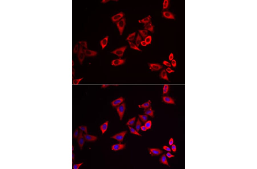 Immunofluorescence - Anti-RPL9 Antibody (A15214) - Antibodies.com