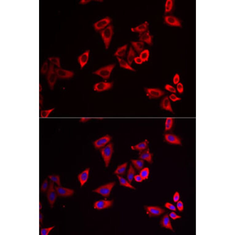 Immunofluorescence - Anti-RPL9 Antibody (A15214) - Antibodies.com