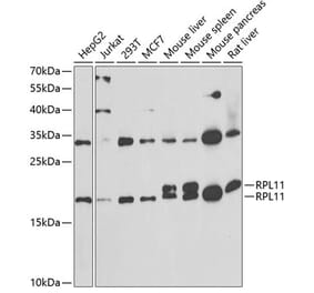 Western Blot - Anti-RPL11 Antibody (A15215) - Antibodies.com