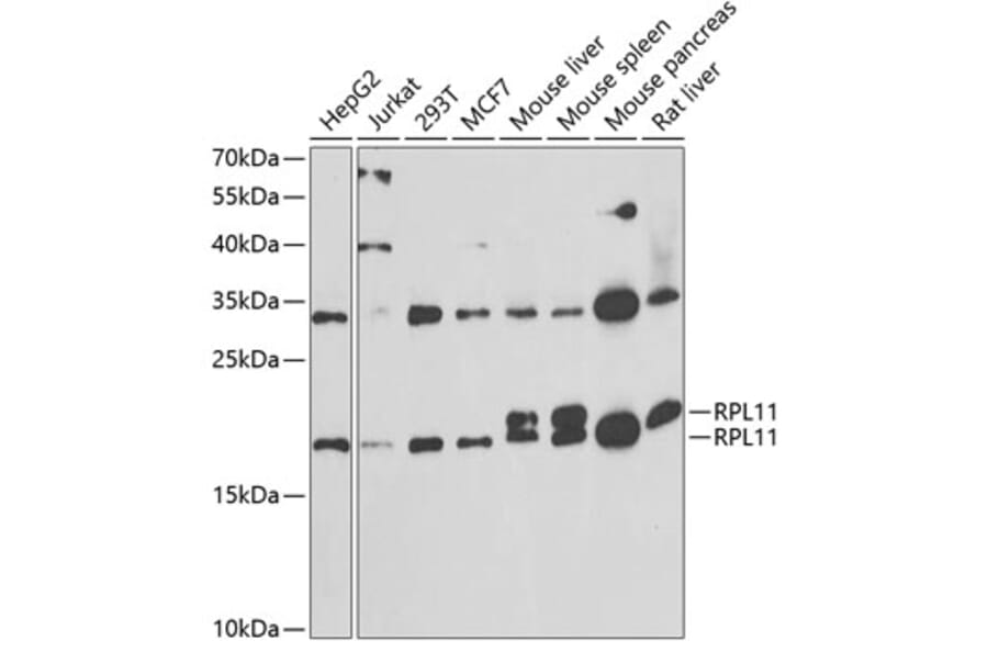 Western Blot - Anti-RPL11 Antibody (A15215) - Antibodies.com