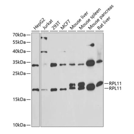 Western Blot - Anti-RPL11 Antibody (A15215) - Antibodies.com