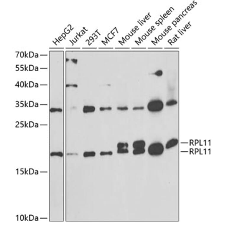 Western Blot - Anti-RPL11 Antibody (A15215) - Antibodies.com