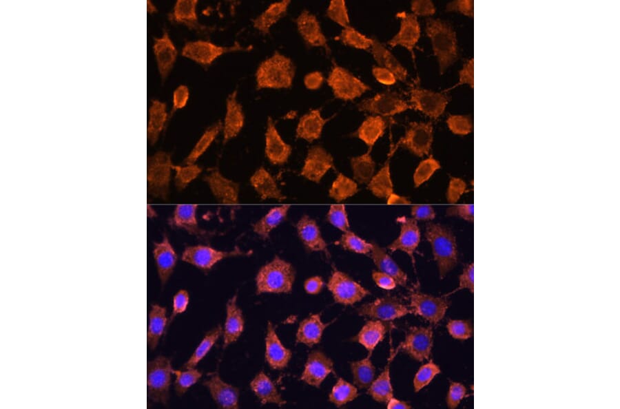 Immunofluorescence - Anti-RPL11 Antibody (A15215) - Antibodies.com