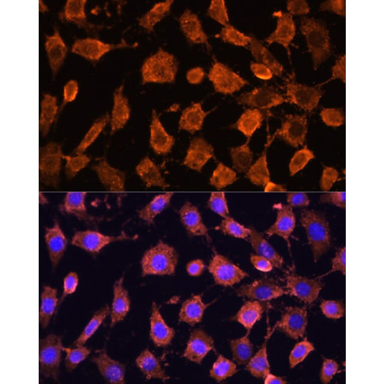 Immunofluorescence - Anti-RPL11 Antibody (A15215) - Antibodies.com