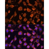 Immunofluorescence - Anti-RPL11 Antibody (A15215) - Antibodies.com