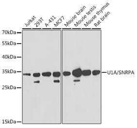 Western Blot - Anti-U1A Antibody (A15217) - Antibodies.com