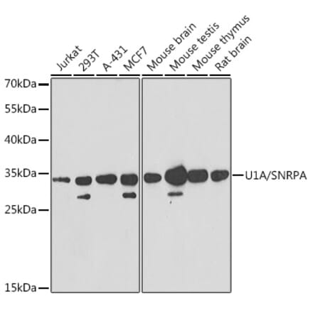 Western Blot - Anti-U1A Antibody (A15217) - Antibodies.com