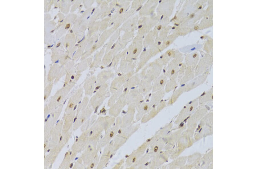 Immunohistochemistry - Anti-U1A Antibody (A15217) - Antibodies.com