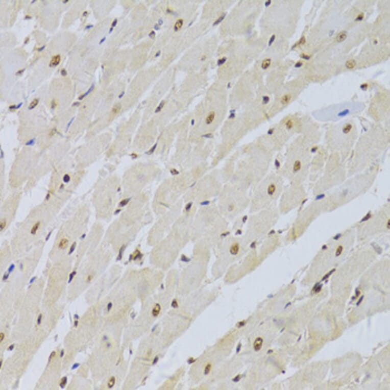 Immunohistochemistry - Anti-U1A Antibody (A15217) - Antibodies.com