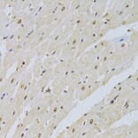Immunohistochemistry - Anti-U1A Antibody (A15217) - Antibodies.com