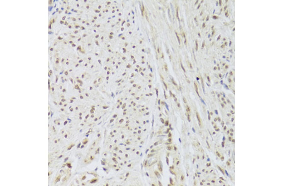 Immunohistochemistry - Anti-U1A Antibody (A15217) - Antibodies.com