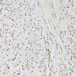 Immunohistochemistry - Anti-U1A Antibody (A15217) - Antibodies.com