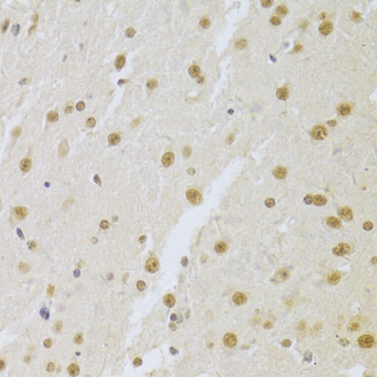 Immunohistochemistry - Anti-U1A Antibody (A15217) - Antibodies.com