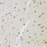 Immunohistochemistry - Anti-U1A Antibody (A15217) - Antibodies.com
