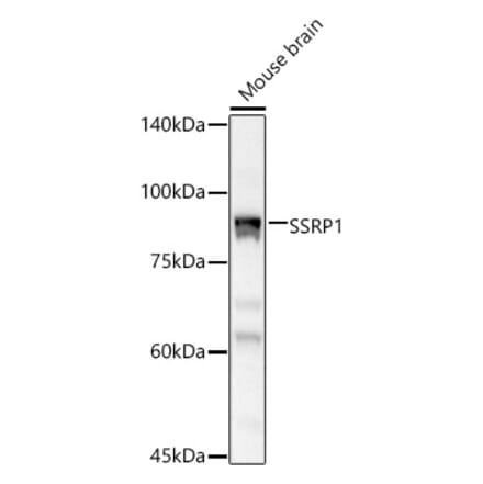 Western Blot - Anti-SSRP1 Antibody (A15218) - Antibodies.com