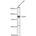 Western Blot - Anti-SSRP1 Antibody (A15218) - Antibodies.com