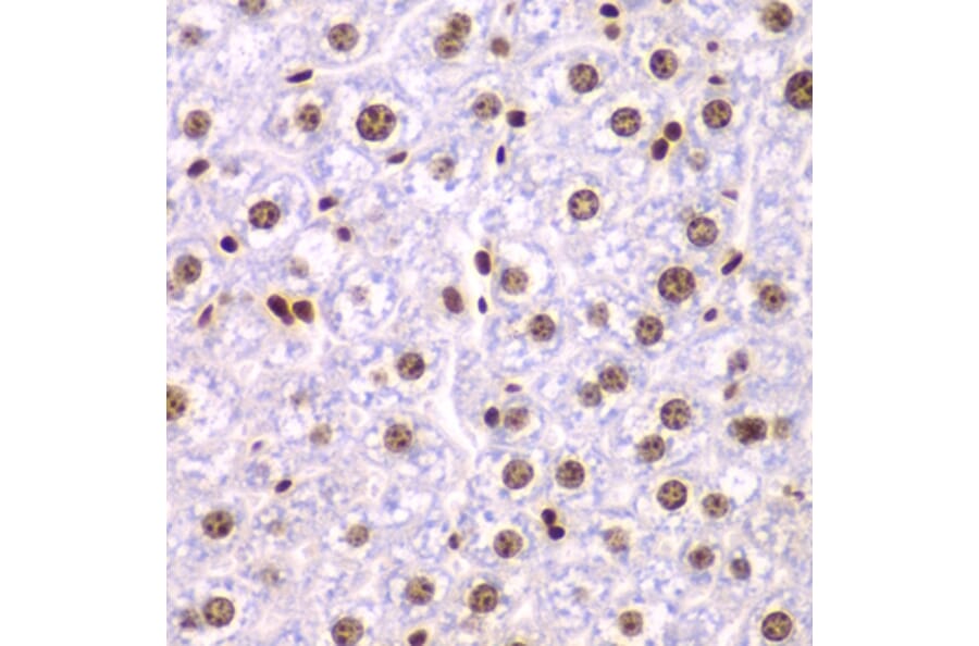 Immunohistochemistry - Anti-SSRP1 Antibody (A15218) - Antibodies.com