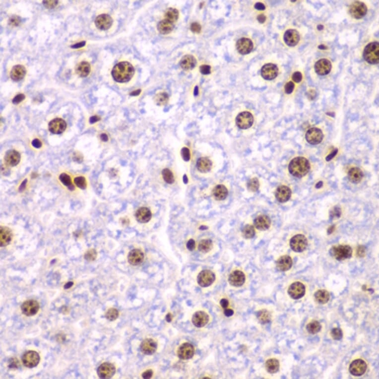 Immunohistochemistry - Anti-SSRP1 Antibody (A15218) - Antibodies.com