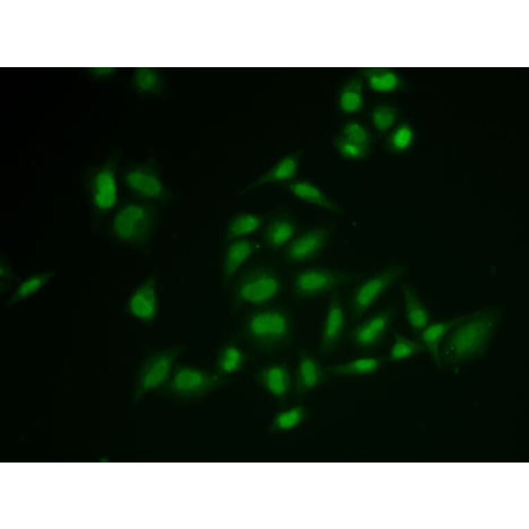 Immunofluorescence - Anti-SSRP1 Antibody (A15218) - Antibodies.com