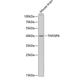 Western Blot - Anti-TSG6 Antibody (A15219) - Antibodies.com
