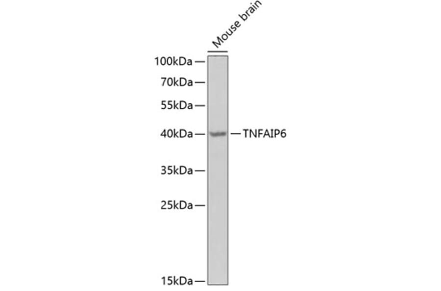 Western Blot - Anti-TSG6 Antibody (A15219) - Antibodies.com