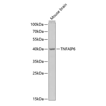 Western Blot - Anti-TSG6 Antibody (A15219) - Antibodies.com