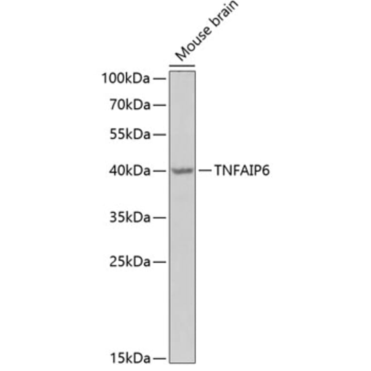Western Blot - Anti-TSG6 Antibody (A15219) - Antibodies.com