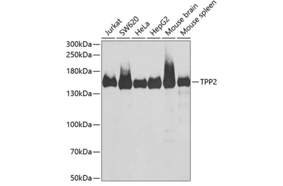 Western Blot - Anti-Tripeptidyl peptidase II/TPPII Antibody (A15220) - Antibodies.com