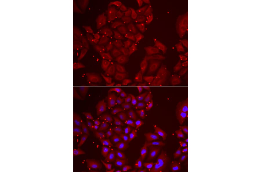 Immunofluorescence - Anti-Tripeptidyl peptidase II/TPPII Antibody (A15220) - Antibodies.com