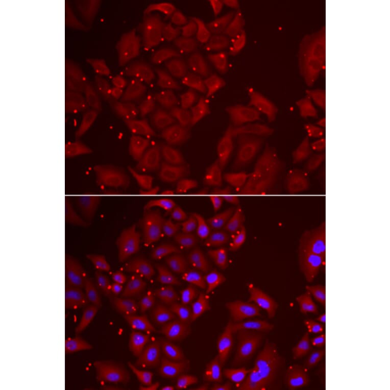 Immunofluorescence - Anti-Tripeptidyl peptidase II/TPPII Antibody (A15220) - Antibodies.com