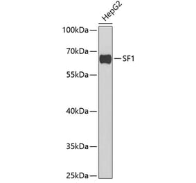 Western Blot - Anti-splicing factor 1 Antibody (A15221) - Antibodies.com