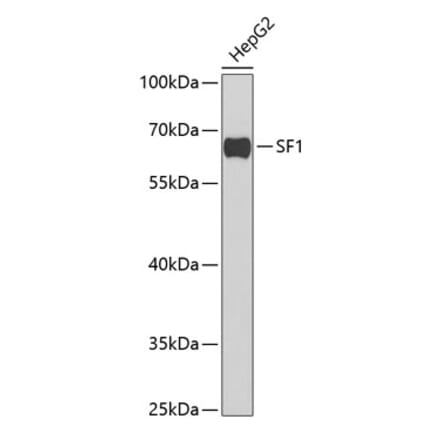 Western Blot - Anti-splicing factor 1 Antibody (A15221) - Antibodies.com