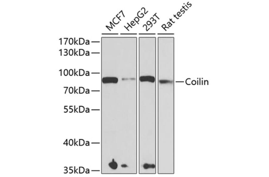 Western Blot - Anti-Coilin Antibody (A15222) - Antibodies.com