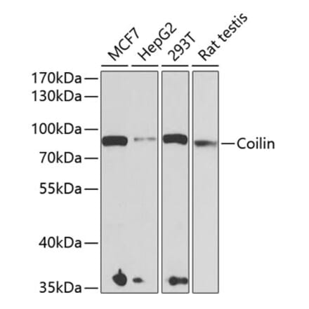 Western Blot - Anti-Coilin Antibody (A15222) - Antibodies.com