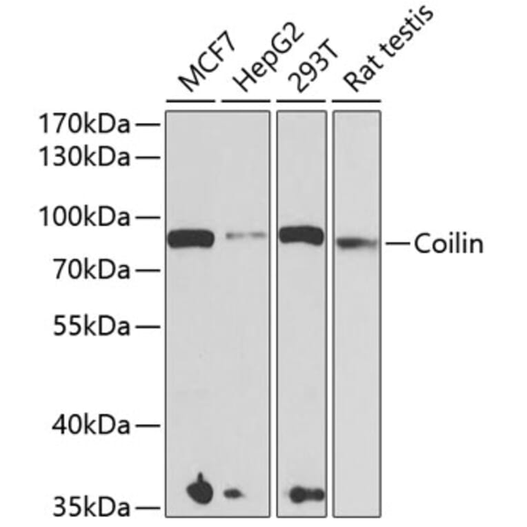 Western Blot - Anti-Coilin Antibody (A15222) - Antibodies.com