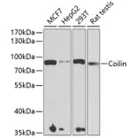 Western Blot - Anti-Coilin Antibody (A15222) - Antibodies.com