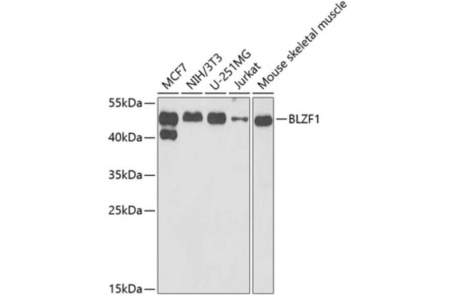 Western Blot - Anti-BLZF1 Antibody (A15223) - Antibodies.com
